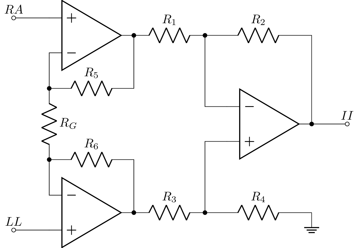 ecg_II