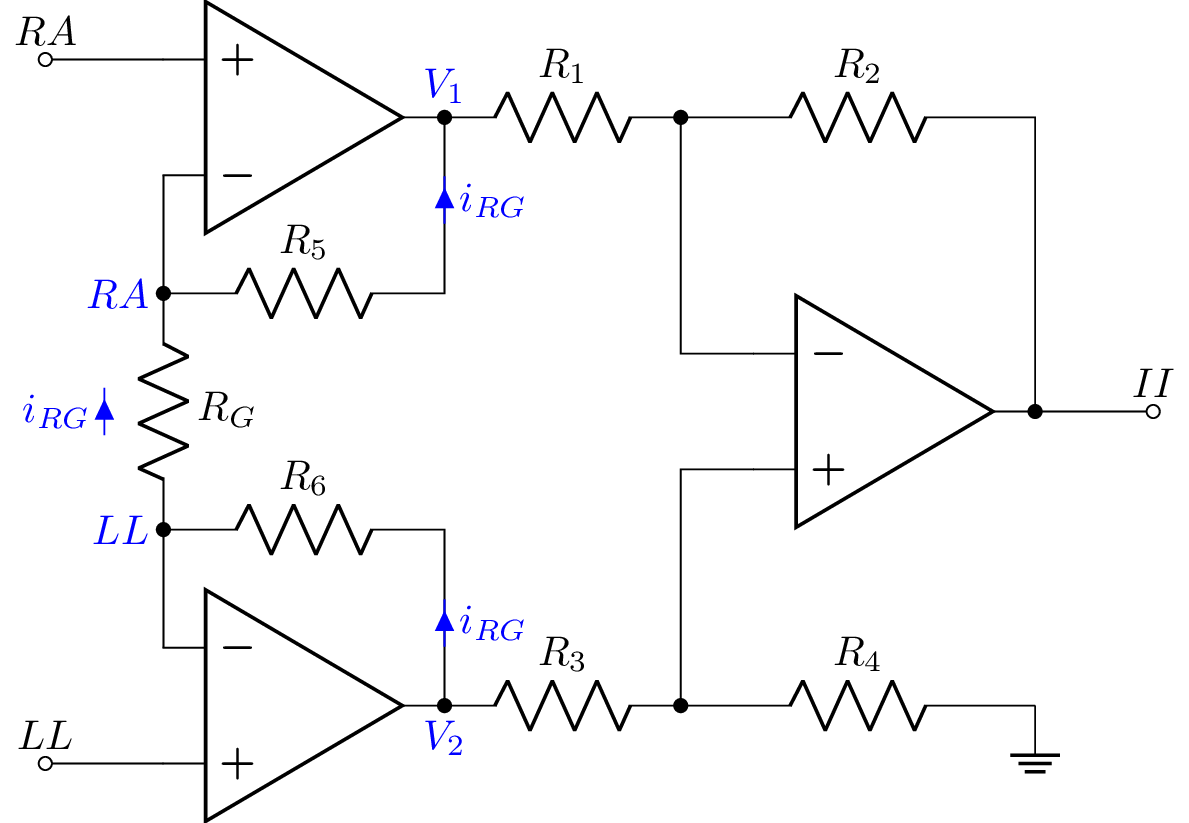 ecg_II_annotated